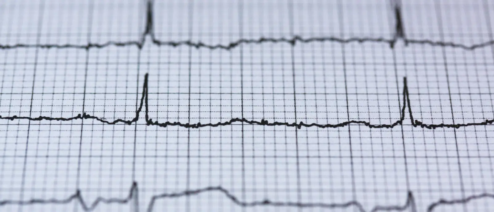 Interview with Javier González, Materials Engineer and founder of The Open Ventilator